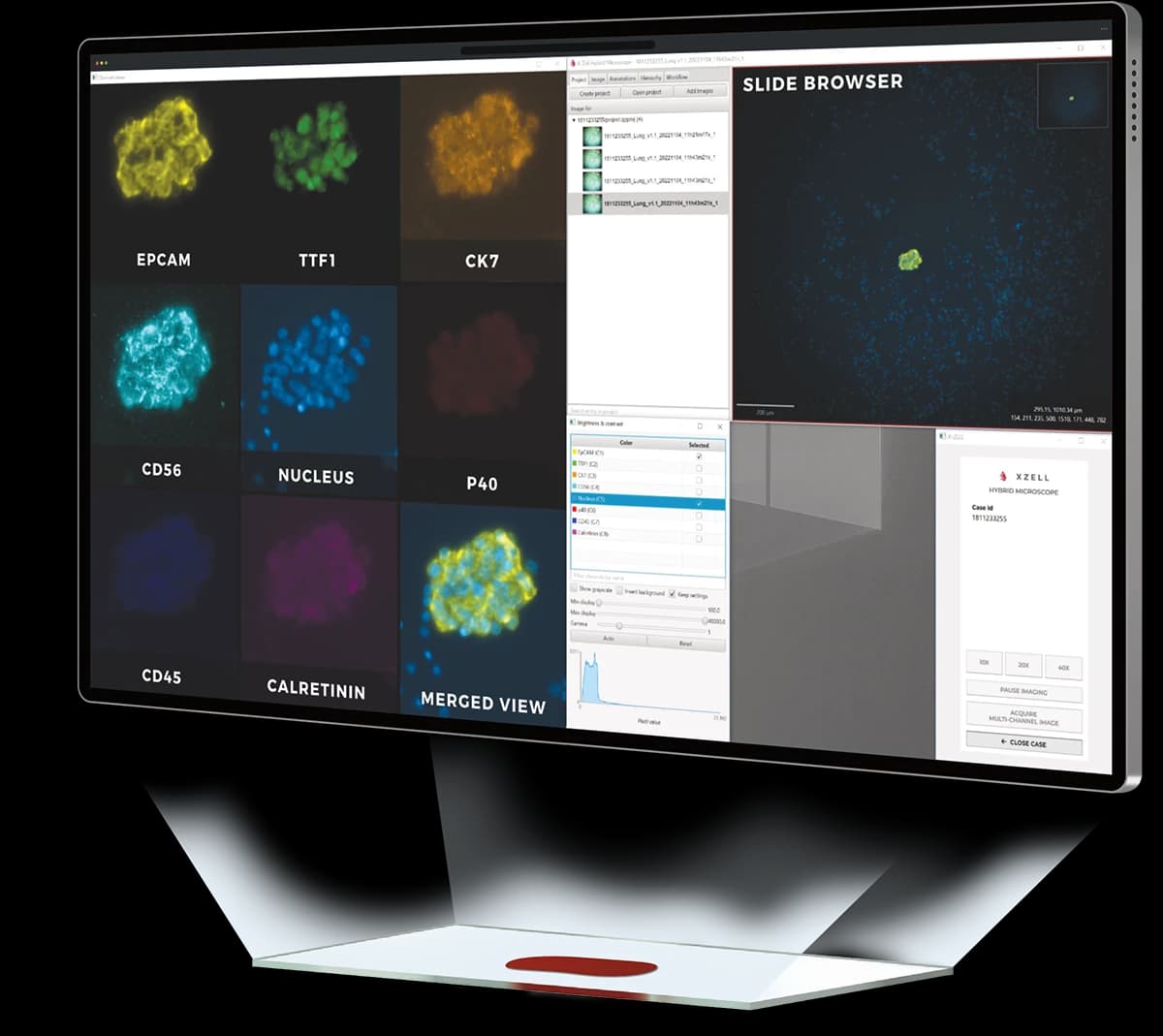X-ZELL Hybrid Microscope software showing multiplex fluorescence channels for cytology review